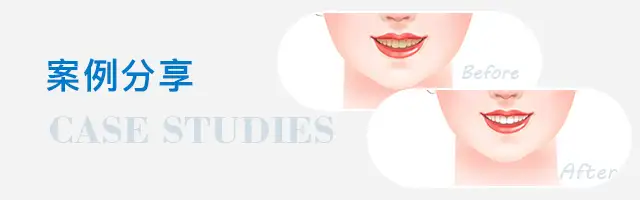 深圳種牙&深圳維港口腔