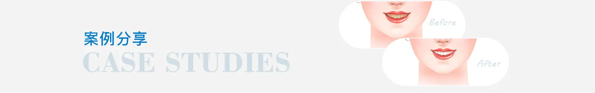 深圳種牙&深圳維港口腔