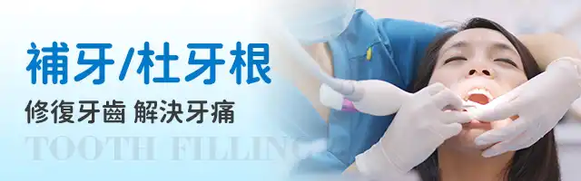 深圳補牙_杜牙根