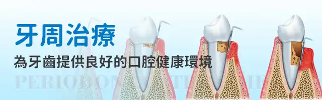 深圳牙周病&牙周治療