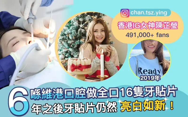 ig女神維港睇牙
